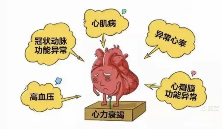 心力衰竭知多少